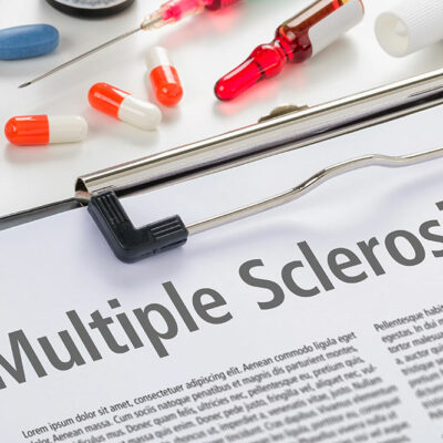 MS – Types and Risk Factors