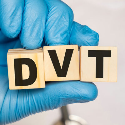 DVT – Complications and Prevention