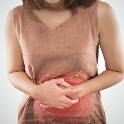 Symptoms and Trigger Foods of Ulcerative Colitis